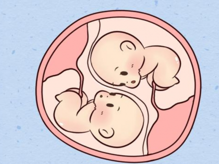 试管婴儿双胞胎要注意哪些问题