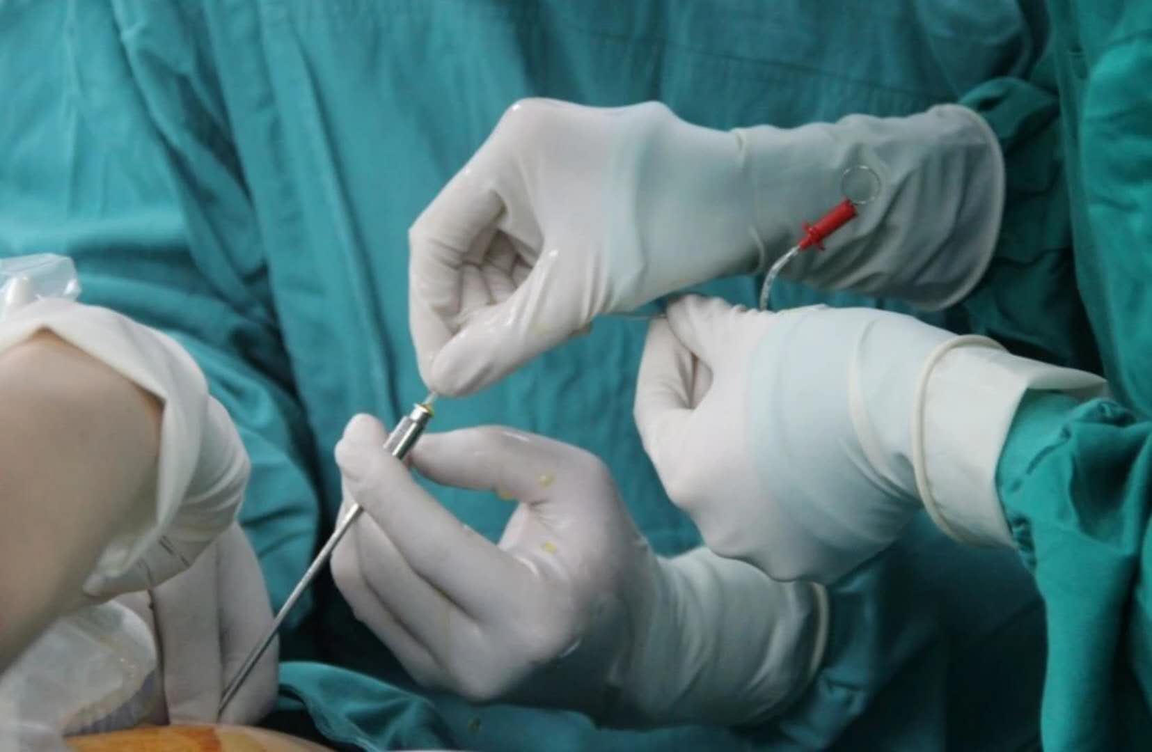 安徽试管医院排名,试管医院推荐