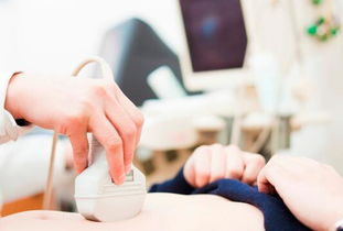 青海试管医院,试管婴儿