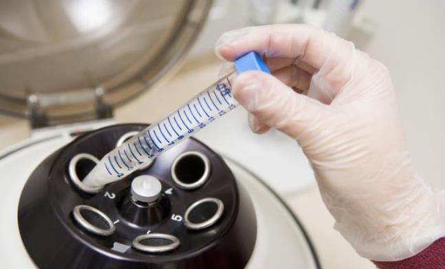 太原试管医院,试管婴儿