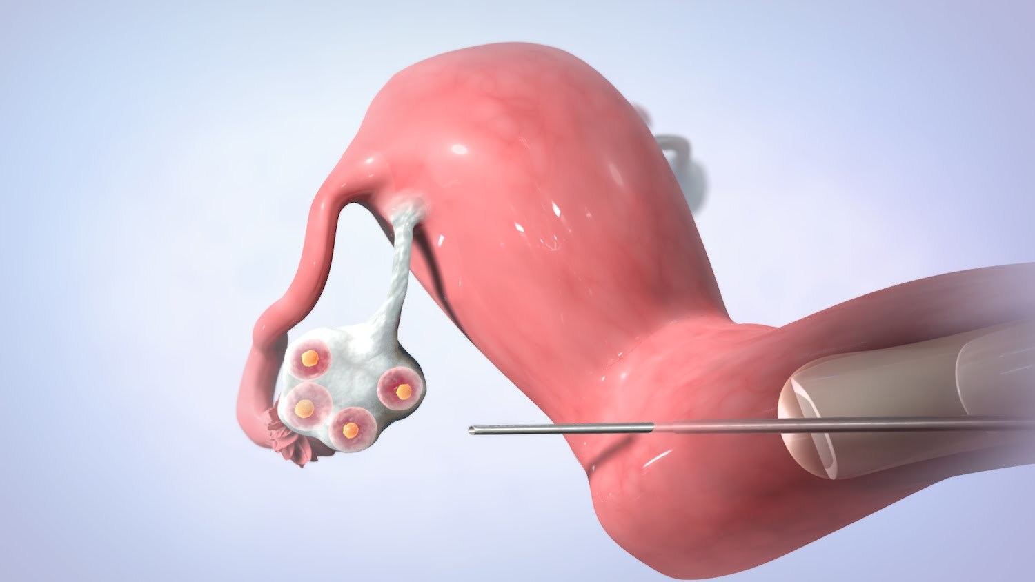 洛阳试管婴儿,试管医院,试管费用