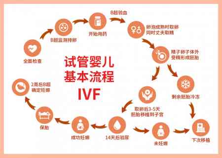 试管婴儿流程