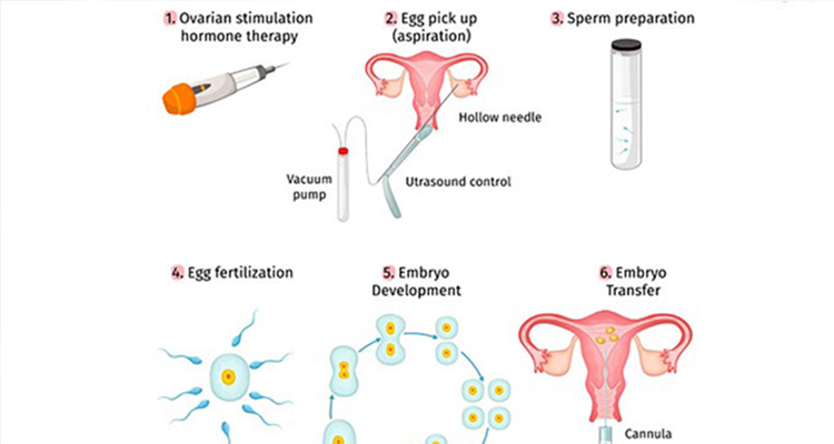 泰国试管婴儿的全部过程,做泰国试管婴儿的流程时间