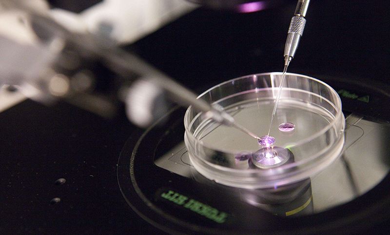 女方试管检查,试管项目