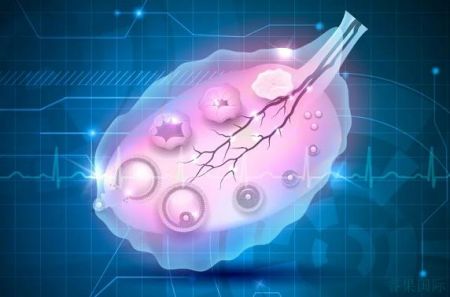 女性不孕的原因