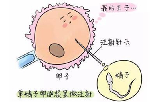  试管婴儿取精注意事项分享
